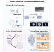 3D打印骨软骨谱系特异性双相支架用于关节软骨全层缺损修复