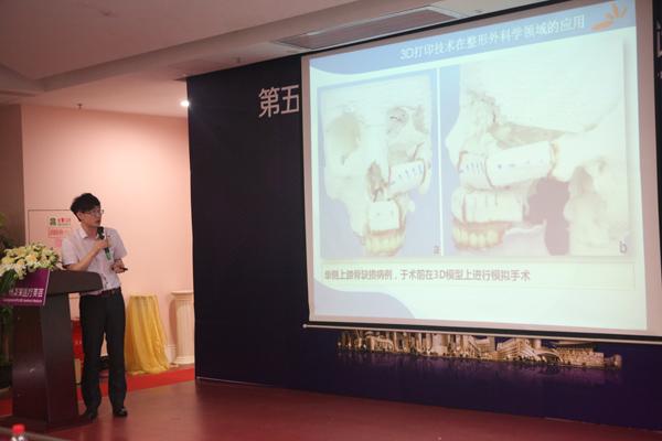 3D打印隆鼻!鼻整形技术实现革命性突破