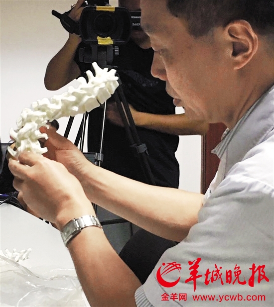 3D打印脊椎助14岁'蜘蛛人'挺直腰杆 术后'长高'十厘米