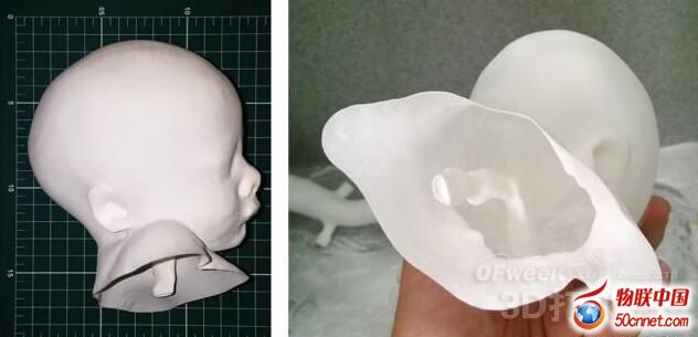 3Dӡоϵ֮3DӡҽѧĽ