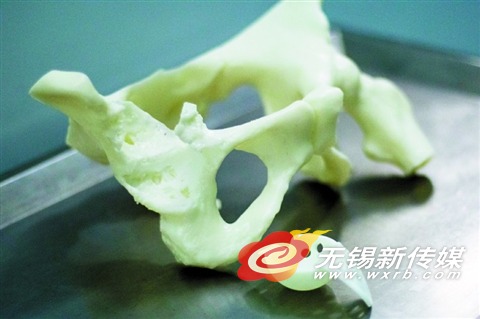 ͼΪ3Dӡ֬͹ؽڱϼ塣