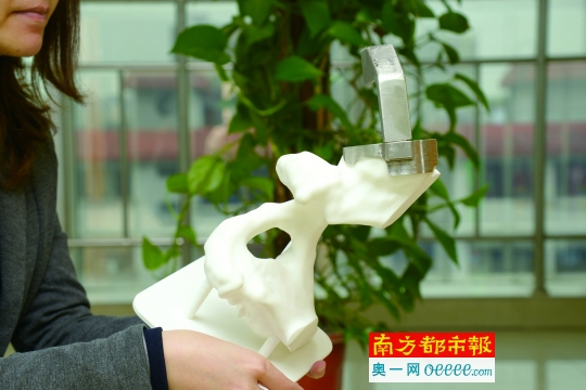 3D打印 成为骨科医生“超级帮手”