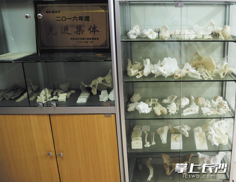 3D打印的骨骼模型。