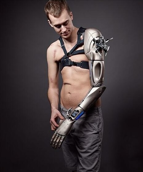 英国假肢生产商Open Bionics参加世界首例3D打印仿生手临床试验