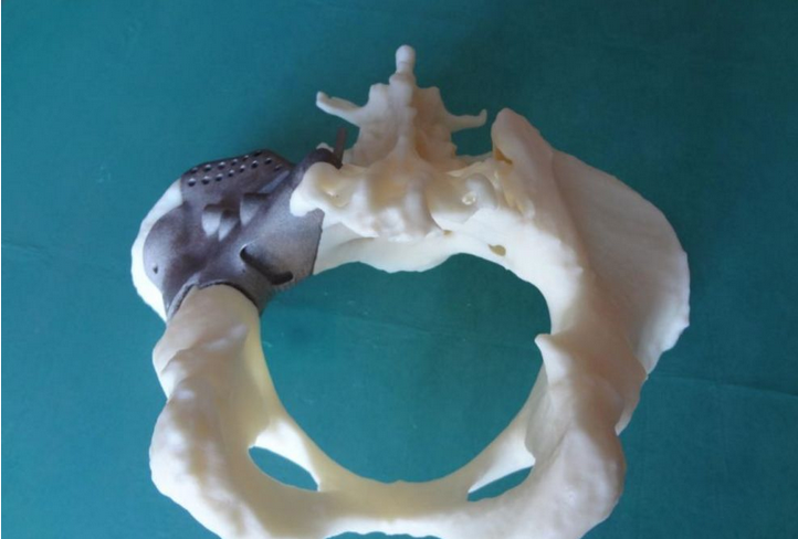 ֯3DӡӡΪδϣ