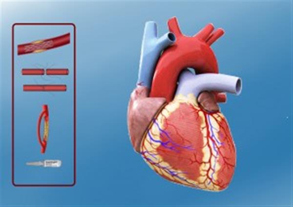 Heartbits项目用3D打印模型和VR向患者展示他们的心脏缺陷 Heartbits项目用3D打印模型和VR向患者展示他们的心脏缺陷