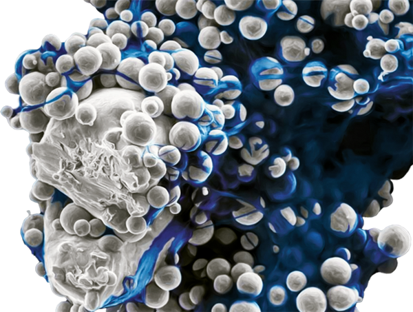 Stryker公司的3D打印腰椎骨盆“Tritanium”获FDA批准 Stryker公司的3D打印腰椎骨盆“Tritanium”获FDA批准