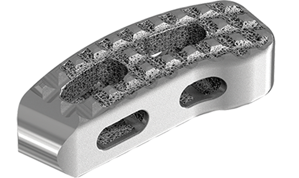Stryker公司的3D打印腰椎骨盆“Tritanium”获FDA批准 Stryker公司的3D打印腰椎骨盆“Tritanium”获FDA批准