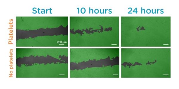 富含血小板的生物墨水可以促进3D打印植入物和皮肤移植物的愈合 富含血小板的生物墨水可以促进3D打印植入物和皮肤移植物的愈合