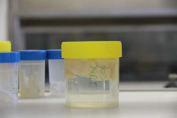 科学家们使用生物3D打印和鳄鱼软骨治疗关节损伤及关节炎 科学家们使用生物3D打印和鳄鱼软骨治疗关节损伤及关节炎
