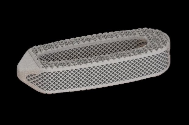 OSSEUS 3D打印脊柱植入物Aries获得FDA批准 OSSEUS 3D打印脊柱植入物Aries获得FDA批准