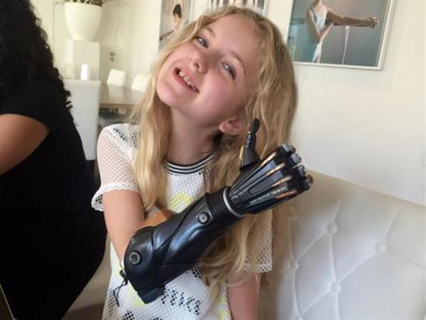 Open Bionics获466万英镑投资为儿童3D打印仿生手臂 Open Bionics获466万英镑投资为儿童3D打印仿生手臂