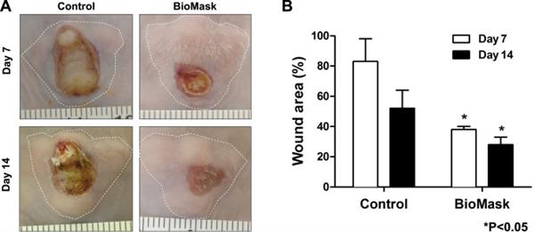 生物3D打印BioMask可以快速治愈面部皮肤伤口 生物3D打印BioMask可以快速治愈面部皮肤伤口
