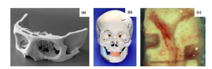 深度解析:3D打印骨组织工程支架研究 深度解析:3D打印骨组织工程支架研究