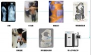 3D打印脊柱侧弯矫形器：科技为青少年挺直脊梁