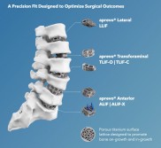 Carlsmed拟纳斯达克上市，筹资7.25亿元加速3D打印脊柱植入物技术升级