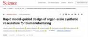 《Science》：斯坦福大学为3D打印心脏设计器官尺度的血管网络模型