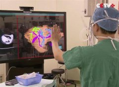 <b>上海医院借助3D打印成功分离一对连体男婴</b> <b>上海医院借助3D打印成功分离一对连体男婴</b>