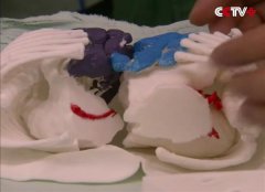 <b>3D打印助上海复旦大学附属儿童医院完成连体婴分离手术</b> <b>3D打印助上海复旦大学附属儿童医院完成连体婴分离手术</b>