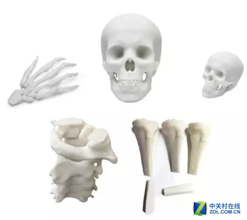 TCT亚洲展:3D打印在骨板设计中的应用