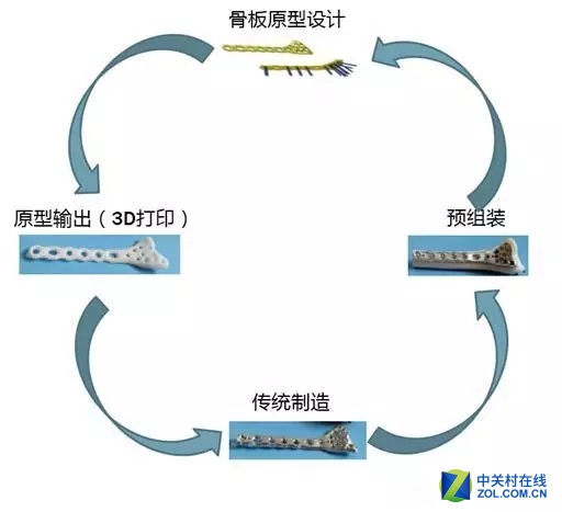TCT亚洲展:3D打印在骨板设计中的应用