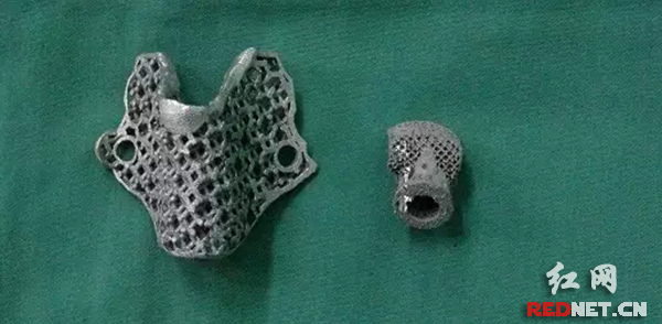 3DӡƳ˹׵壬뻼߱ļȫһ¡