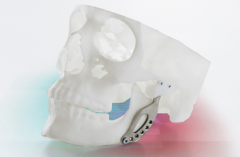 <b>Mach73Dӡҽƹ˾3D Medicalʽɺϲ</b>