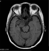 <b>如何能活着把玩自己的颅骨?3D打印帮你实现!</b> <b>如何能活着把玩自己的颅骨?3D打印帮你实现!</b>
