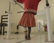 <b>多伦多大学在发展中国家推广3D打印假肢技术</b> <b>多伦多大学在发展中国家推广3D打印假肢技术</b>