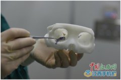 <b>����ʡ�ۿ��״�����3D��ӡ���� �޸��ۿ����뾫׼ʱ��</b>