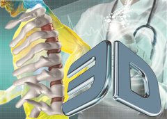 <b>ҽ3Dӡ 뼼</b>
