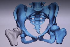 <b>加拿大启动医疗3D打印项目 打开创新研究大门</b> <b>加拿大启动医疗3D打印项目 打开创新研究大门</b>