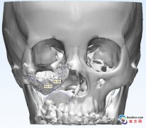 <b>ݳɹʵʩ3Dӡ޸</b>