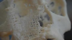 <b>丹麦科研人员制作出史上首个不被活体排斥的3D打印骨植入物</b> <b>丹麦科研人员制作出史上首个不被活体排斥的3D打印骨植入物</b>