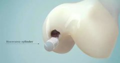 <b>ҽֲгմ3Dӡ߸Ǳ</b>