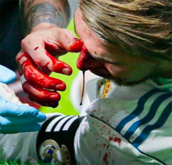 Ī˹뱾ضﾺ0-0ƽ