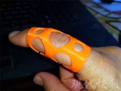 ҽѧΪ㡰˽˶ơ3Dӡ