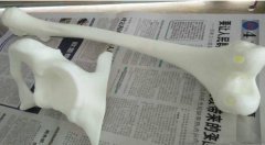 <b>内蒙古3D打印创新中心为国际蒙医院打印术前盆骨、股骨等模型</b> <b>内蒙古3D打印创新中心为国际蒙医院打印术前盆骨、股骨等模型</b>