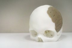 <b>OPM޽3Dӡҽ豸Ӫ</b>