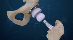 ҽʹCONFORMIS 3DӡֲŹؽû