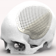 伯明翰大学安装两台雷尼绍多激光器增材制造设备 伯明翰大学安装两台雷尼绍多激光器增材制造设备