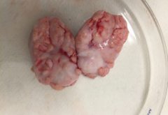 <b>Celprogen Inc.宣布成功使用脑干细胞3D打印人脑细胞器</b> <b>Celprogen Inc.宣布成功使用脑干细胞3D打印人脑细胞器</b>