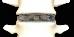 <b>ҽֲϵһ3DӡAries L׵ں</b>