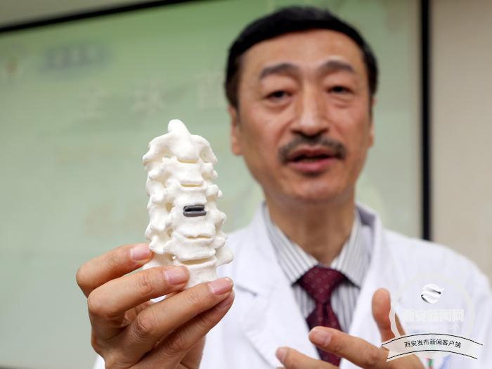 全球首例3D打印人工颈椎间盘置换术助其恢复行走