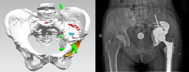 ·ˣ3Dӡ75갢վ