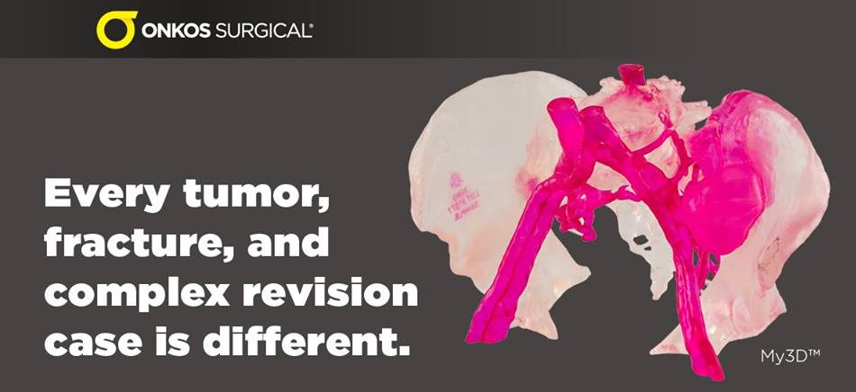Onkos Surgical My3D™个性化解决方案平台 Onkos Surgical My3D™个性化解决方案平台