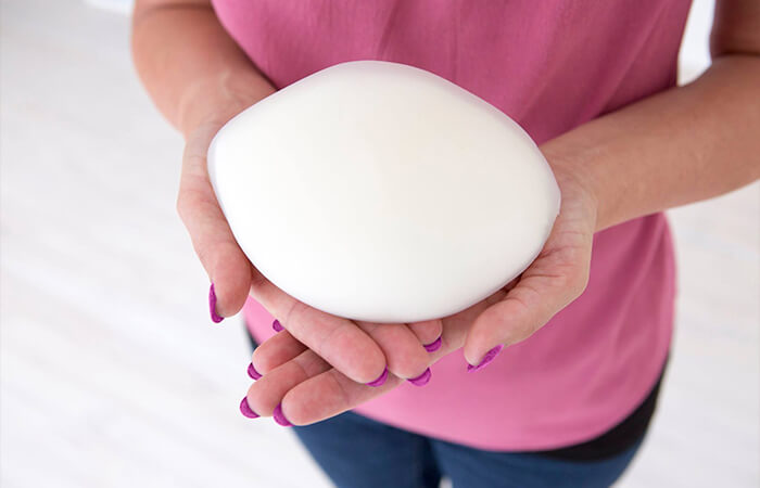 使用3D打印模具制作的定制乳房假体 使用3D打印模具制作的定制乳房假体