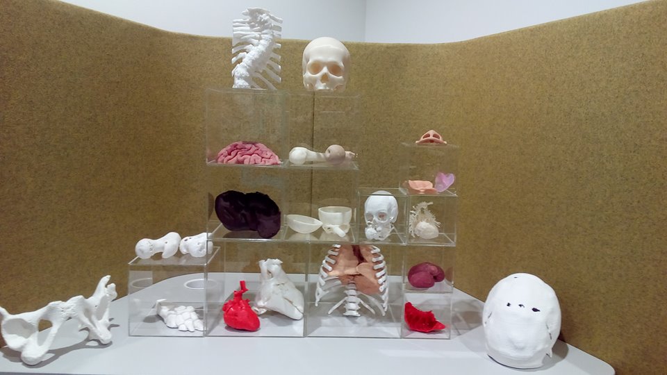 3D LifePrints系列3D打印医学模型 3D LifePrints系列3D打印医学模型