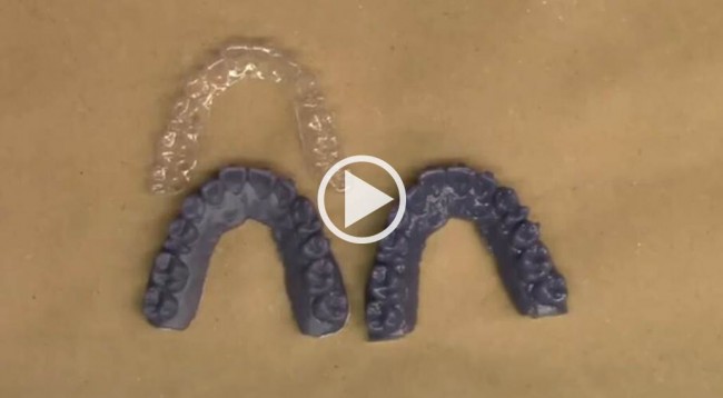 video cover_aligner_Dental