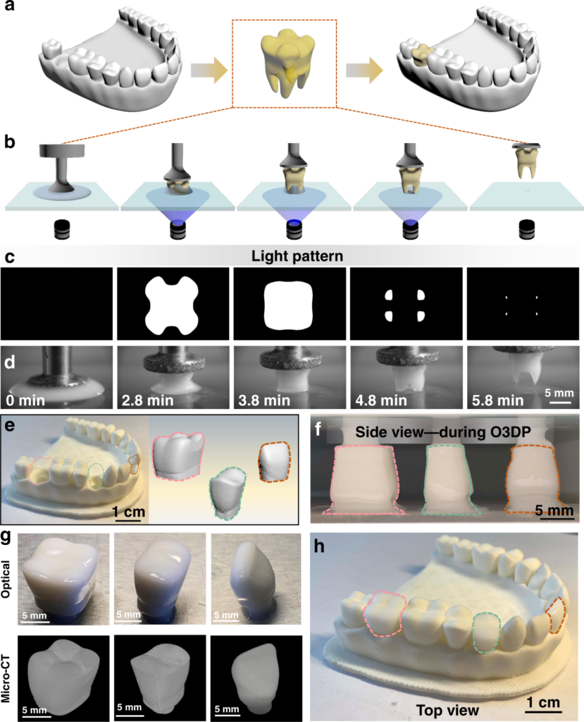 使用连续的一滴3D打印技术对各种牙科对象进行3D打印